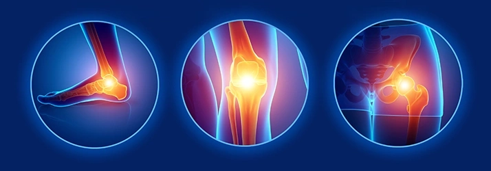 Illustration showing three highlighted joints: ankle, knee, and hip, with glowing pain points indicating inflammation or discomfort
